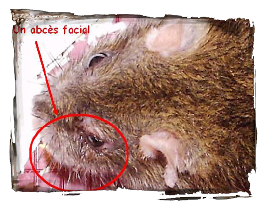 Un abcès facial